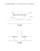 ACCESS AND TISSUE MODIFICATION SYSTEMS AND METHODS diagram and image