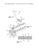 ACCESS AND TISSUE MODIFICATION SYSTEMS AND METHODS diagram and image