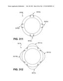 ACCESS AND TISSUE MODIFICATION SYSTEMS AND METHODS diagram and image