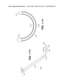 ACCESS AND TISSUE MODIFICATION SYSTEMS AND METHODS diagram and image