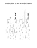 ACCESS AND TISSUE MODIFICATION SYSTEMS AND METHODS diagram and image