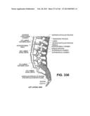 ACCESS AND TISSUE MODIFICATION SYSTEMS AND METHODS diagram and image