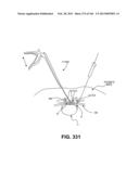 ACCESS AND TISSUE MODIFICATION SYSTEMS AND METHODS diagram and image