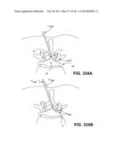 ACCESS AND TISSUE MODIFICATION SYSTEMS AND METHODS diagram and image