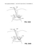 ACCESS AND TISSUE MODIFICATION SYSTEMS AND METHODS diagram and image