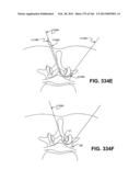 ACCESS AND TISSUE MODIFICATION SYSTEMS AND METHODS diagram and image