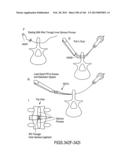 ACCESS AND TISSUE MODIFICATION SYSTEMS AND METHODS diagram and image