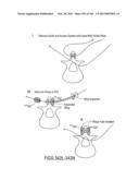 ACCESS AND TISSUE MODIFICATION SYSTEMS AND METHODS diagram and image