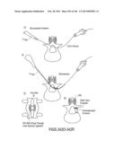 ACCESS AND TISSUE MODIFICATION SYSTEMS AND METHODS diagram and image