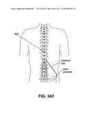 ACCESS AND TISSUE MODIFICATION SYSTEMS AND METHODS diagram and image