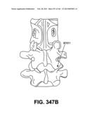 ACCESS AND TISSUE MODIFICATION SYSTEMS AND METHODS diagram and image