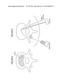 ACCESS AND TISSUE MODIFICATION SYSTEMS AND METHODS diagram and image