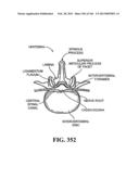 ACCESS AND TISSUE MODIFICATION SYSTEMS AND METHODS diagram and image