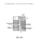 ACCESS AND TISSUE MODIFICATION SYSTEMS AND METHODS diagram and image