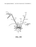 ACCESS AND TISSUE MODIFICATION SYSTEMS AND METHODS diagram and image