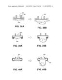 ACCESS AND TISSUE MODIFICATION SYSTEMS AND METHODS diagram and image