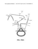 ACCESS AND TISSUE MODIFICATION SYSTEMS AND METHODS diagram and image