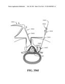 ACCESS AND TISSUE MODIFICATION SYSTEMS AND METHODS diagram and image