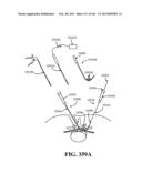 ACCESS AND TISSUE MODIFICATION SYSTEMS AND METHODS diagram and image