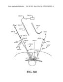 ACCESS AND TISSUE MODIFICATION SYSTEMS AND METHODS diagram and image