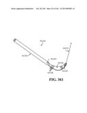 ACCESS AND TISSUE MODIFICATION SYSTEMS AND METHODS diagram and image