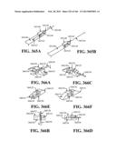 ACCESS AND TISSUE MODIFICATION SYSTEMS AND METHODS diagram and image