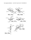 ACCESS AND TISSUE MODIFICATION SYSTEMS AND METHODS diagram and image