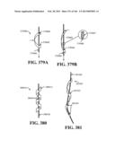 ACCESS AND TISSUE MODIFICATION SYSTEMS AND METHODS diagram and image