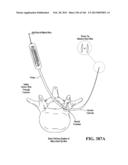 ACCESS AND TISSUE MODIFICATION SYSTEMS AND METHODS diagram and image