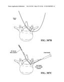 ACCESS AND TISSUE MODIFICATION SYSTEMS AND METHODS diagram and image