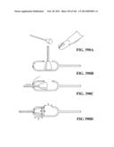 ACCESS AND TISSUE MODIFICATION SYSTEMS AND METHODS diagram and image