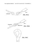 ACCESS AND TISSUE MODIFICATION SYSTEMS AND METHODS diagram and image