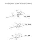 ACCESS AND TISSUE MODIFICATION SYSTEMS AND METHODS diagram and image