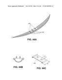 ACCESS AND TISSUE MODIFICATION SYSTEMS AND METHODS diagram and image