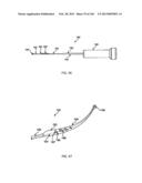 ACCESS AND TISSUE MODIFICATION SYSTEMS AND METHODS diagram and image