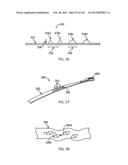 ACCESS AND TISSUE MODIFICATION SYSTEMS AND METHODS diagram and image