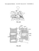 ACCESS AND TISSUE MODIFICATION SYSTEMS AND METHODS diagram and image