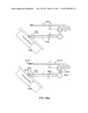 ACCESS AND TISSUE MODIFICATION SYSTEMS AND METHODS diagram and image