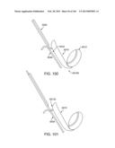 ACCESS AND TISSUE MODIFICATION SYSTEMS AND METHODS diagram and image