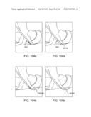 ACCESS AND TISSUE MODIFICATION SYSTEMS AND METHODS diagram and image