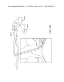 ACCESS AND TISSUE MODIFICATION SYSTEMS AND METHODS diagram and image