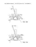 ACCESS AND TISSUE MODIFICATION SYSTEMS AND METHODS diagram and image