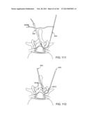 ACCESS AND TISSUE MODIFICATION SYSTEMS AND METHODS diagram and image