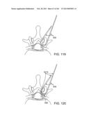 ACCESS AND TISSUE MODIFICATION SYSTEMS AND METHODS diagram and image