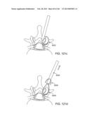 ACCESS AND TISSUE MODIFICATION SYSTEMS AND METHODS diagram and image