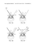 ACCESS AND TISSUE MODIFICATION SYSTEMS AND METHODS diagram and image