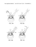 ACCESS AND TISSUE MODIFICATION SYSTEMS AND METHODS diagram and image