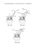 ACCESS AND TISSUE MODIFICATION SYSTEMS AND METHODS diagram and image