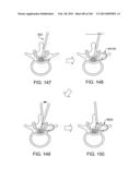 ACCESS AND TISSUE MODIFICATION SYSTEMS AND METHODS diagram and image