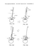 ACCESS AND TISSUE MODIFICATION SYSTEMS AND METHODS diagram and image